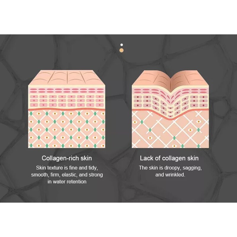 RF Beauty Instrument Manufacturer - Nutrition Introduction Collagen LED DOT Matrix for Wrinkle Removal