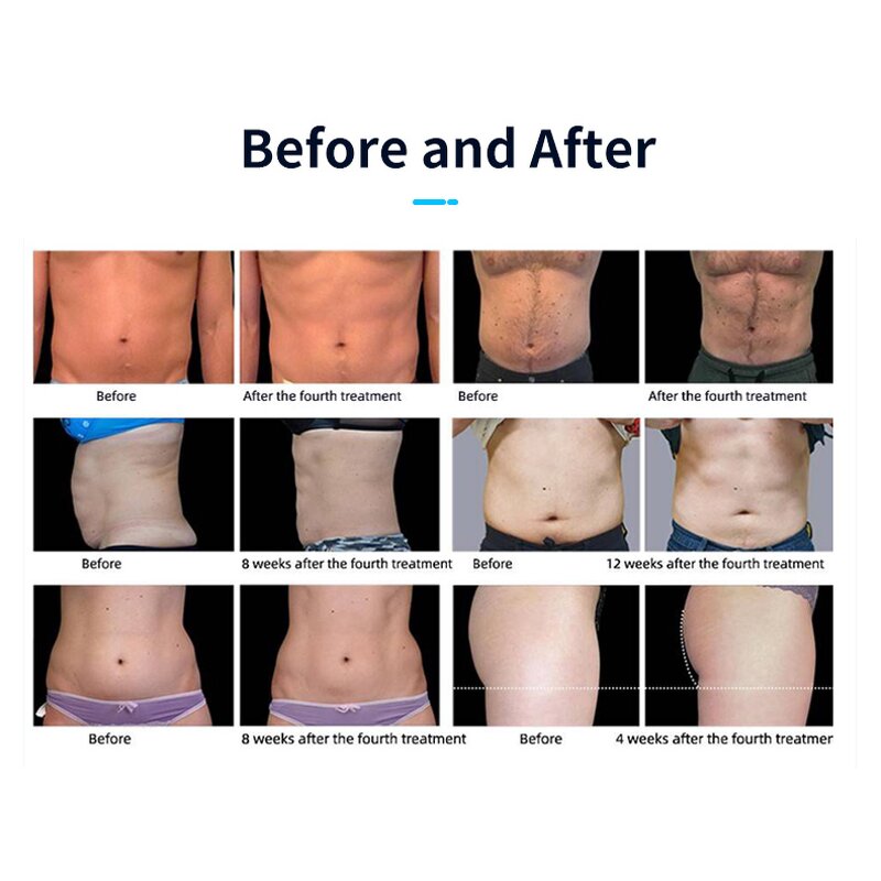 Body EMS Machine Manufacturer - Professional Electromagnetic Wave & RF for Belly Fat Burning