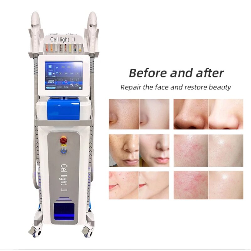 Multi Wave Beauty Machine - Newest Anti-aging Freckle Hair Removal Tool