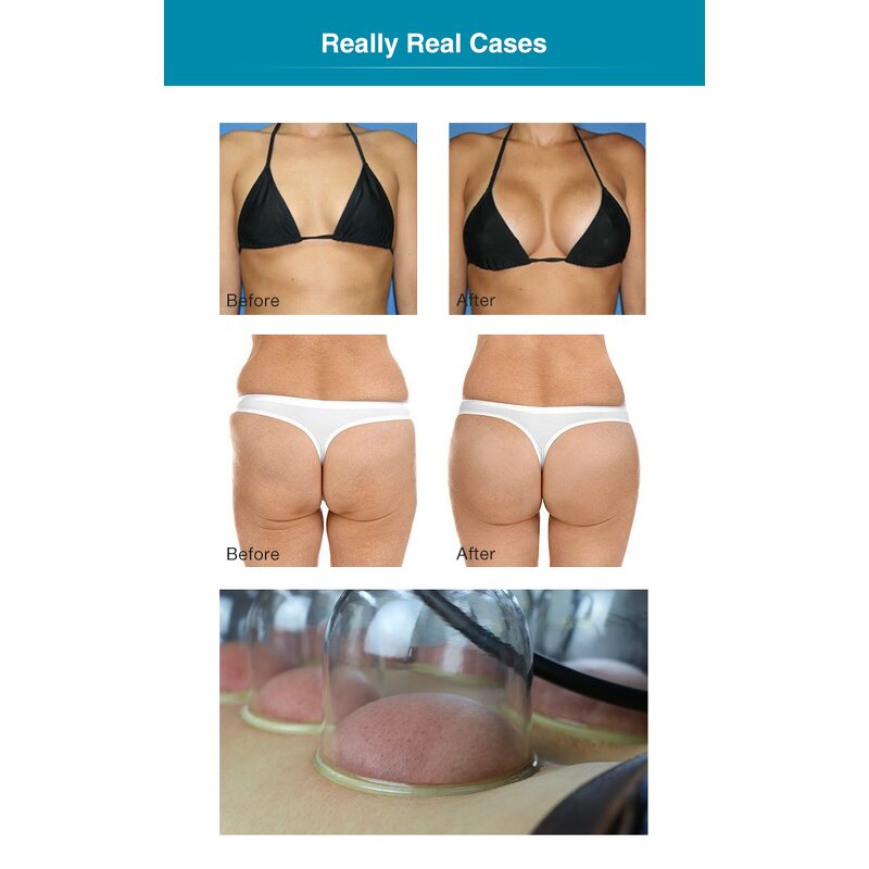 Vacuum Suction Machine - Large Size Breast Butt Enlargement Massage Tool