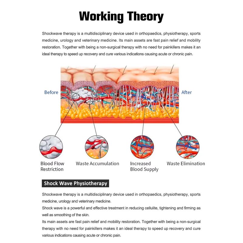 Focused Shock Wave Machine - Body Therapy Muscle Relief Painless Device