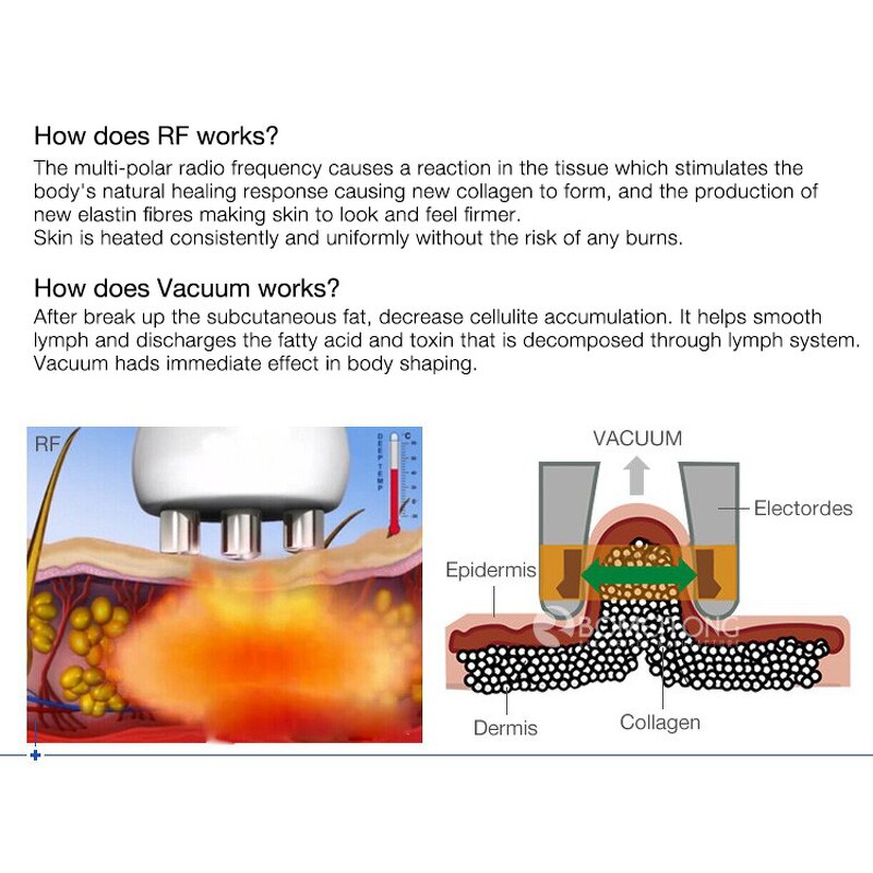 40K Cavit Machine - Portable Slimming Sculpting Fat Burning Vacuum Tool