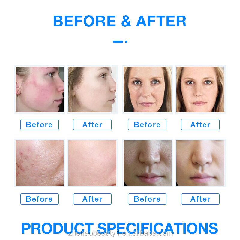 7-Color LED Massager - Red Light Therapy Face Neck Home Beauty Tool