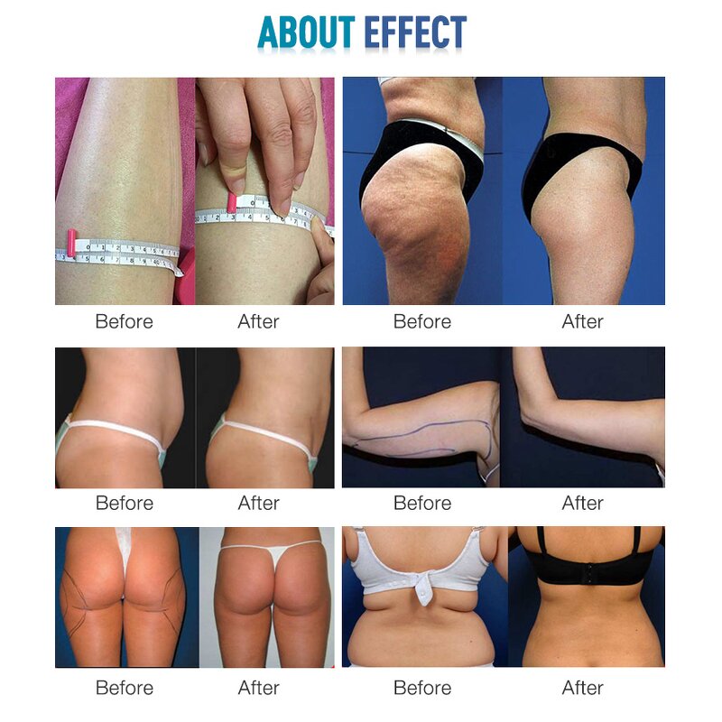 7-in-1 S Shape Machine - 40K 30K 80K Lipo Weight Loss Slimming Tool