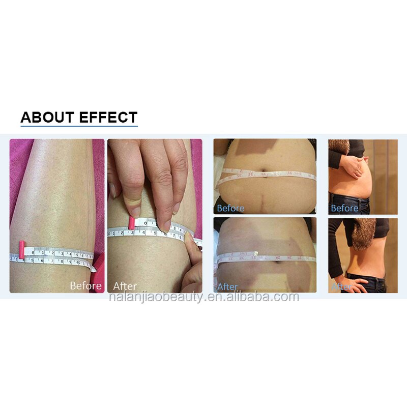 Anti-Cellulite Machine - Fast Slim Body Sculpt Fat Reduction Tool