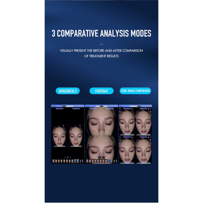 Skin Analysis Equipment - Facial Type Testing Salon Beauty Center Tool