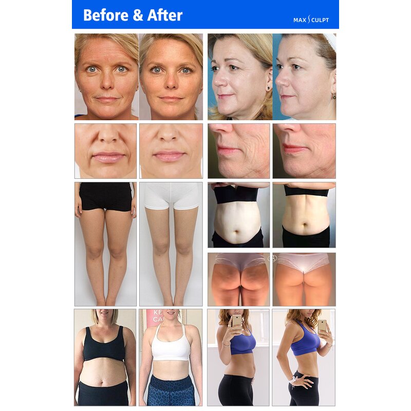 Vertical Vela Slim Machine - 40K Cavit RF Fat Removal Face Lifting Device