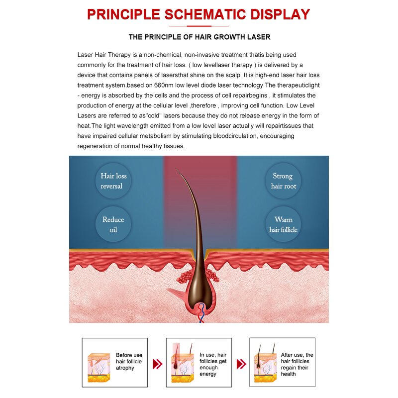 Laser Hair Growth Cap - Diode LED Light Anti Hair Loss Scalp Massage Machine