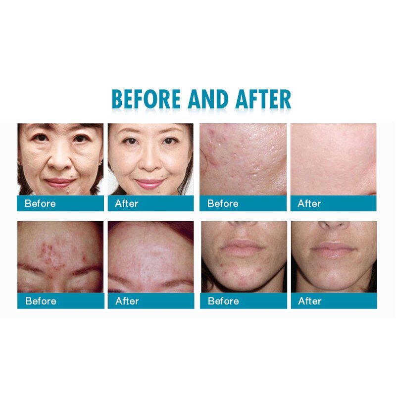 Red Light Therapy Device - 7 Colors Facial Skin Rejuvenation Beauty Tool