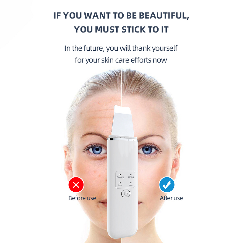 Skin Scrubber Manufacturer - Face Spatula Pore Clean Facial Skin Scraper Beauty Machine