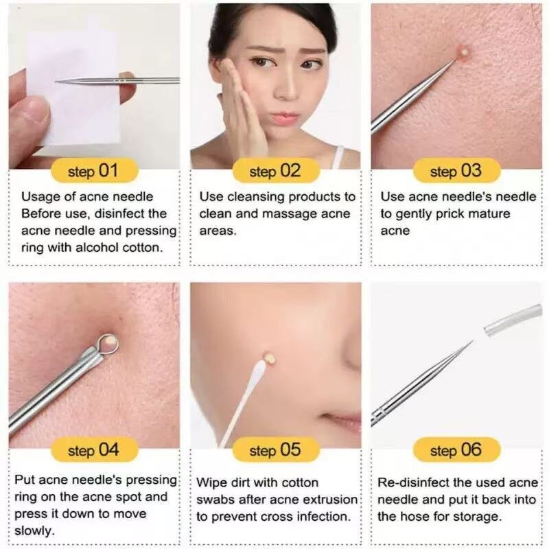 Pimple Popper Tool Manufacturer - Professional Stainless Steel Remove Blackheads Acne with Tin Box