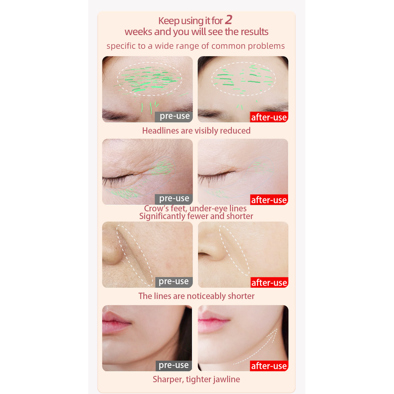 Beauty Facial Wand Manufacturer - 7 in 1 EMS Microcurrent Skincare Red Light Therapy with Stand