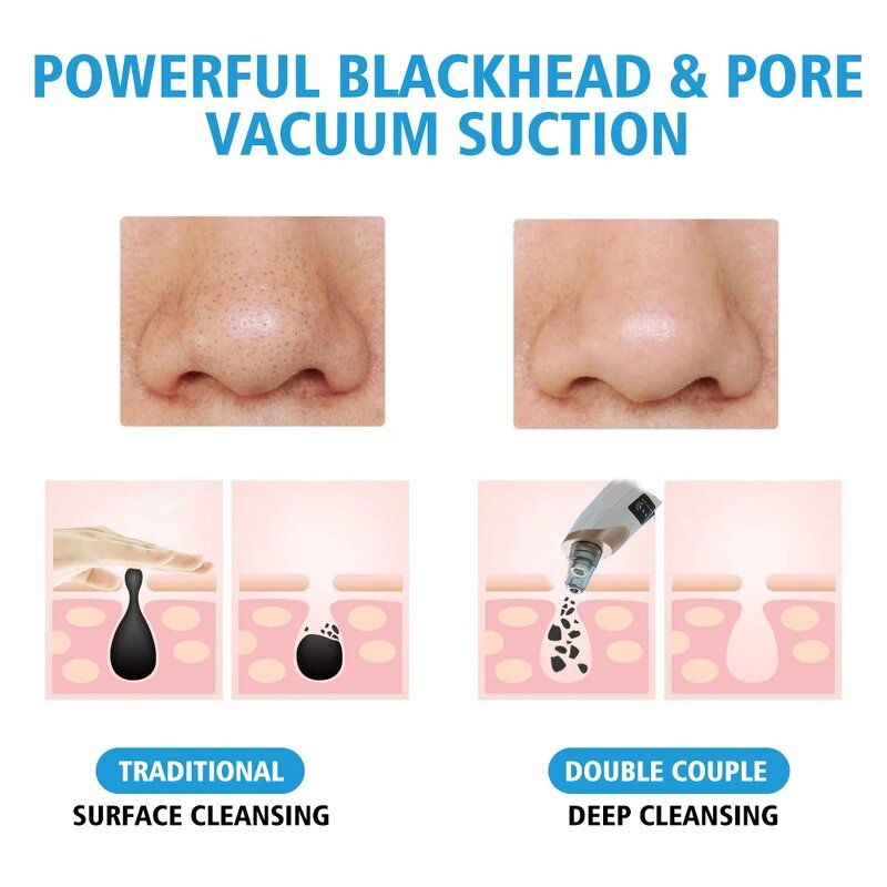Pore Cleaner Manufacturer - Home Eco-friendly USB Rechargeable Facial Blackhead Removal