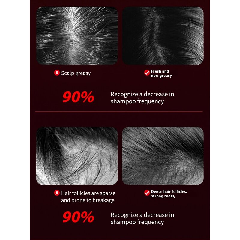 Scalp Massage Brush Manufacturer - Red Blue Light Therapy Vibrating Oil Spray Hair Growth