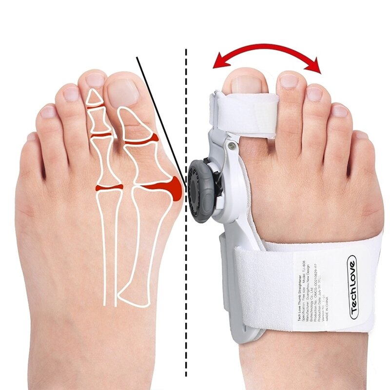 Bunion Corrector Splint - Multi-directional Adjustable Hallux Valgus Toe Separator