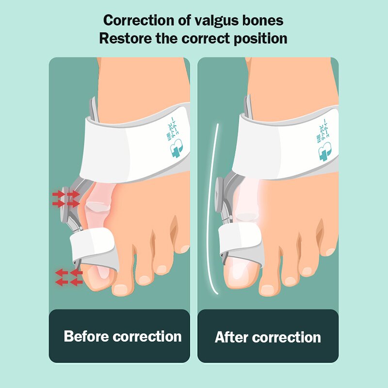 Bunion Correct Kit - Hot Selling Silicone Toe Separator Spiky Foot Massage Ball