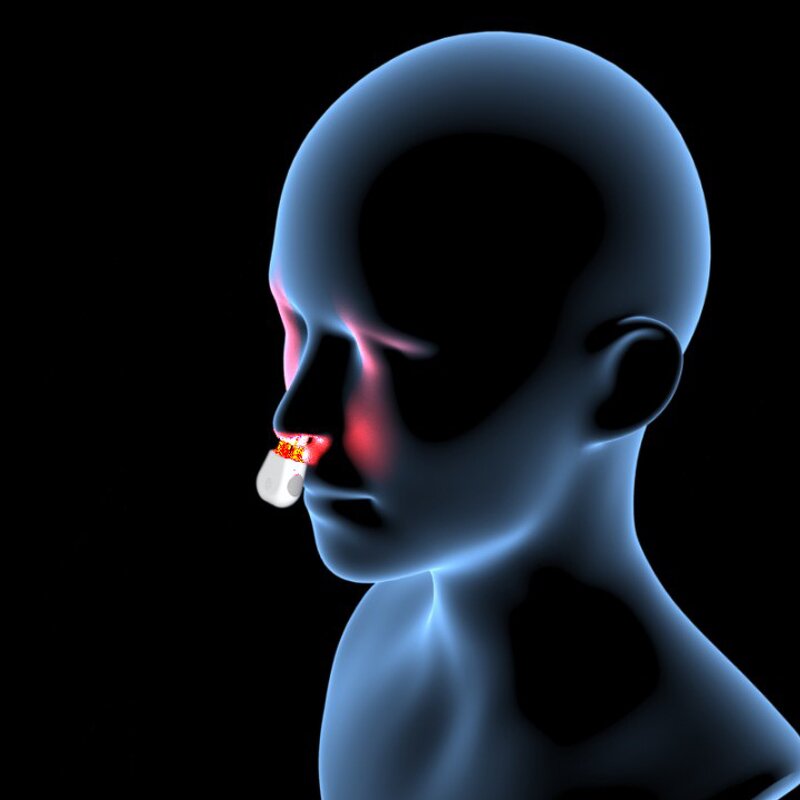 Nasal Laser Therapy - Portable Infrared Low Level Light Sinusitis Healthcare Tool