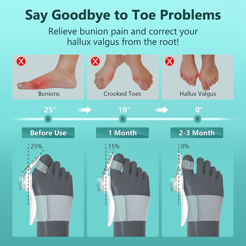 Day & Night Bunion Splint - TENICORE Hallux Valgus Medical Toe Orthopedic Corrector