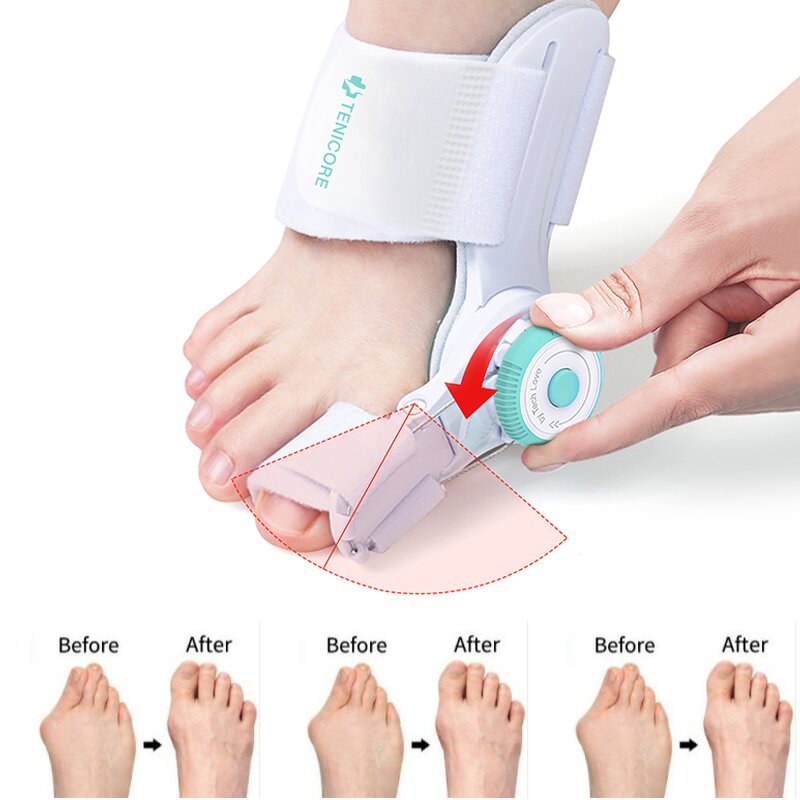 Toe Stabilizer Splint - Metatarsal Pad Gel Bunion Big Toe Straightener Tool