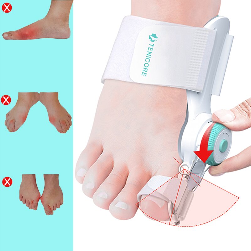 Silicone Bunion Protector - New Hallux Valgus Gel Elastic Foot Plantar Care Tool