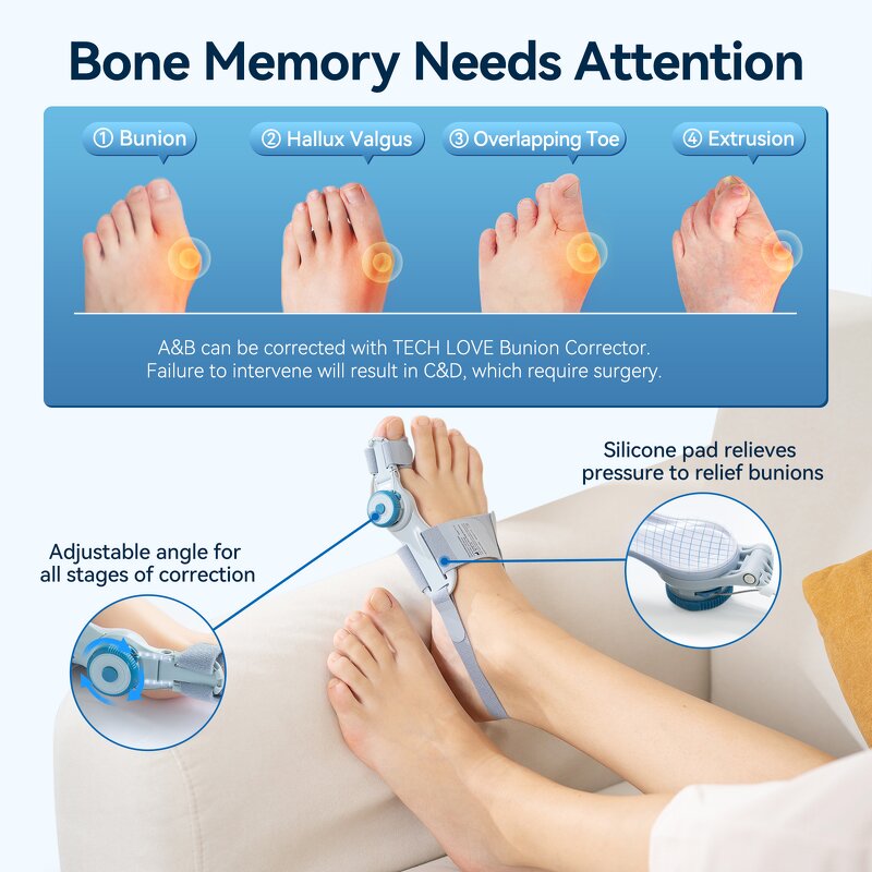 Hammer Toe Bunion Corrector - Tech Love Flexible Orthopaedic Big Toe Splint