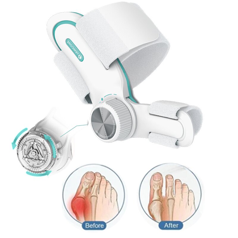 Valgus Toe Separator - Splitter Spacer Bunion Foot Correction Straightener Tool