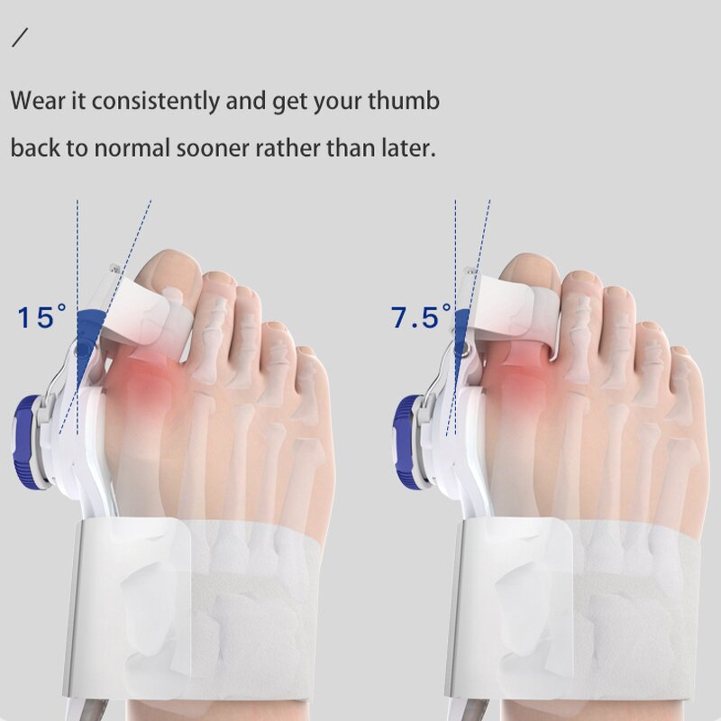 Blue Hallux Valgus Corrector - Techbeauty 2023 Factory Toe Separator Stretcher