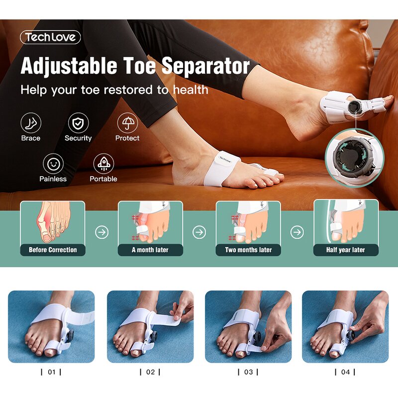 Bunion Corrector Splint - Multi-directional Adjustable Hallux Valgus Toe Separator