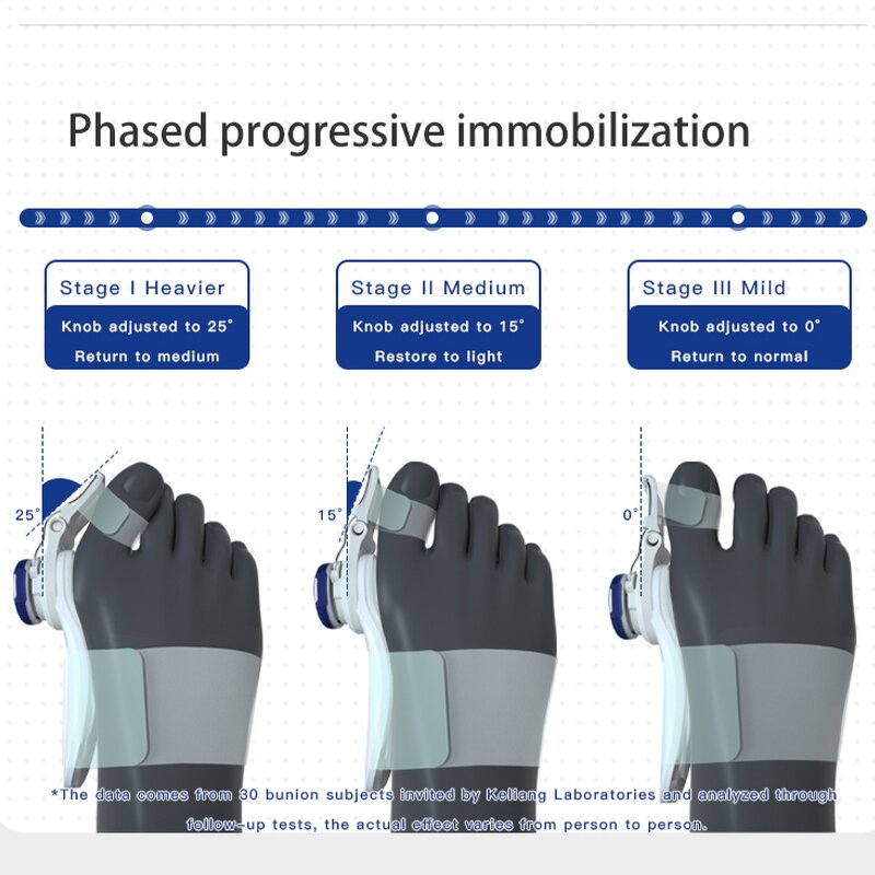 Blue Bunion Corrector - Techbeauty 2023 Supplier New Tailors Ortopedic Device
