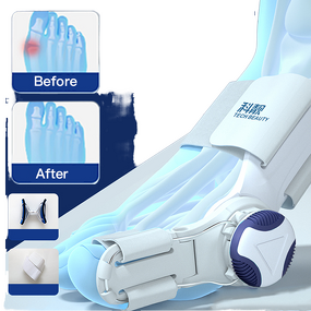 Blue Hallux Valgus Corrector - Techbeauty 2023 Factory Toe Separator Stretcher