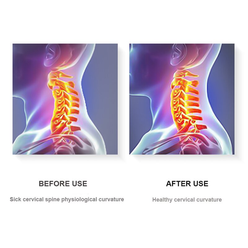 Inflatable Cervical Collar - LK CE Certified Hospital Head Pain Relief Support