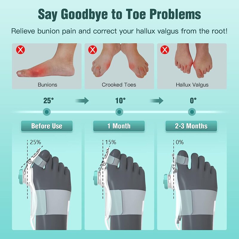 Ergonomic Bunion Corrector - TENICORE Hallux Valgus Big Toe Support Separator