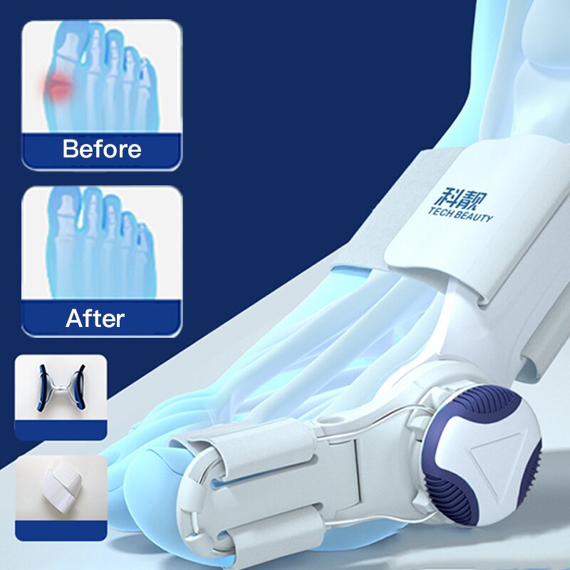Blue Bunion Corrector - Techbeauty 2023 Supplier New Tailors Ortopedic Device