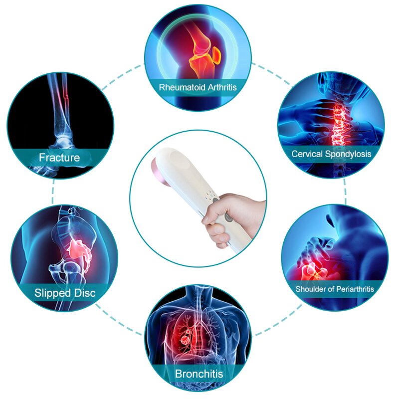 Red Light Therapy Device Manufacturer - for Acute Joint Pain Relief 650nm 808nm