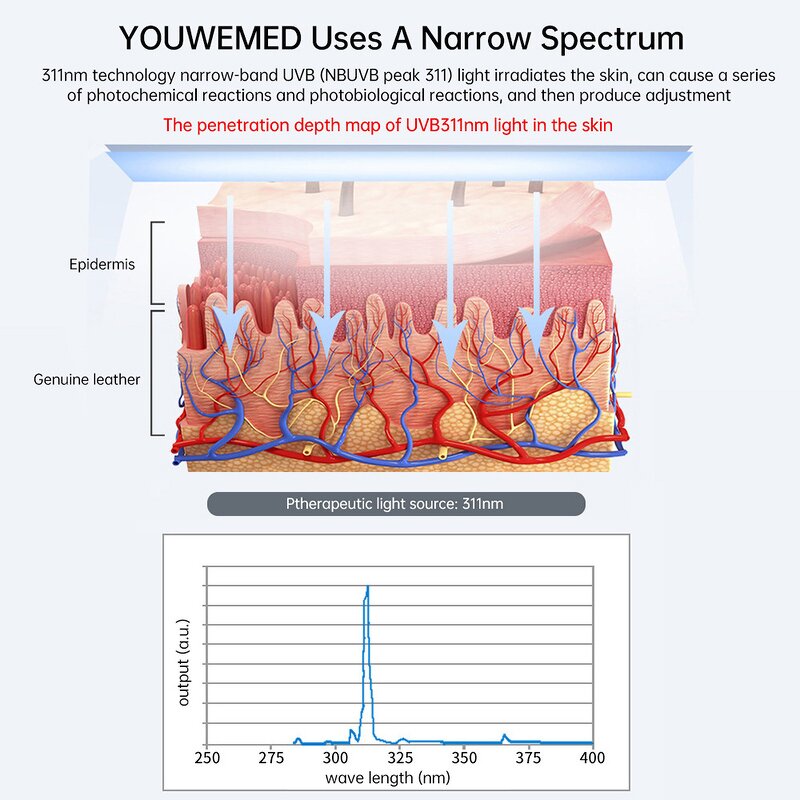 Ultraviolet Lamp Manufacturer - Narrowband 311NM UVB Phototherapy for Anti Vitiligo Psoriasis