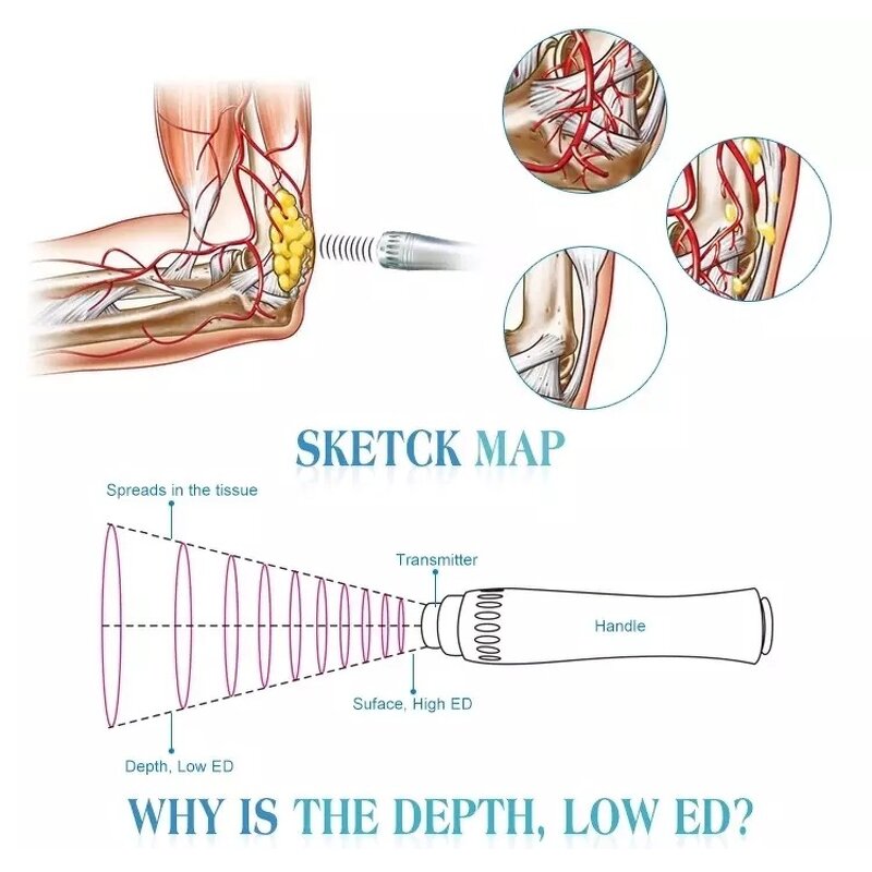 Shockwave Machine Manufacturer - Professional Electromagnetic Extracorporeal for Body Relax Muscle
