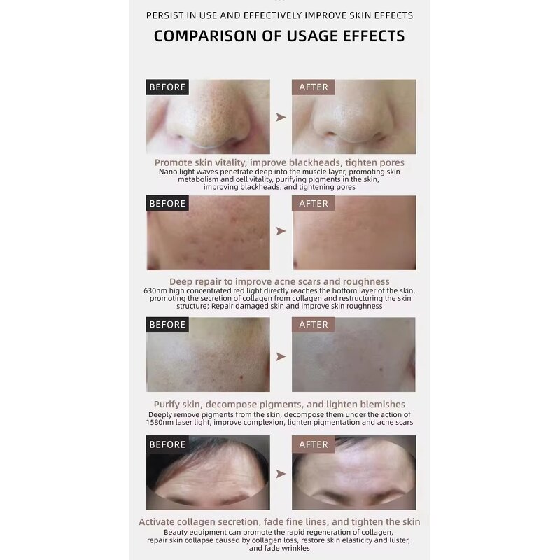 LED Facial Mask Manufacturer - Portable Wireless Wholesale Price Infrared with USB for Home