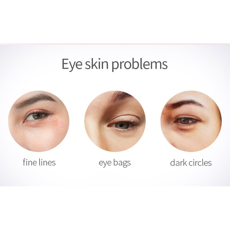 Eye Cream Booster Wand - 40 Degree Heat Vibration Fine Lines Remover