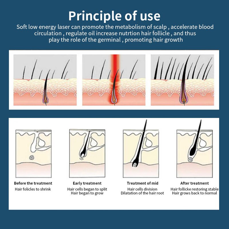 Laser Hair Growth Comb - Best Selling Anti-Hair Loss Massage Brush