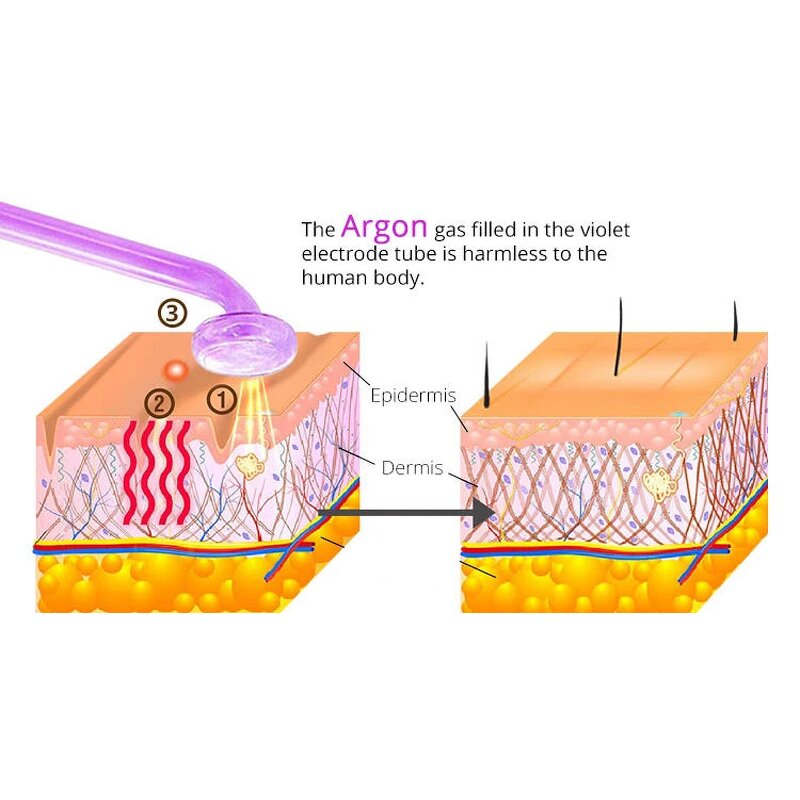 Facial Massager - Hot Selling Home Use Face Lifting Beauty Equipment