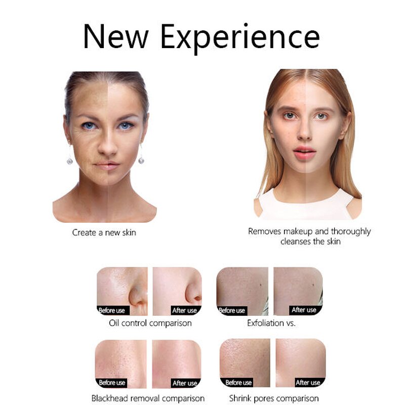 Electric Blackhead Suction Instrument - New Arrival Household Face Care Tool