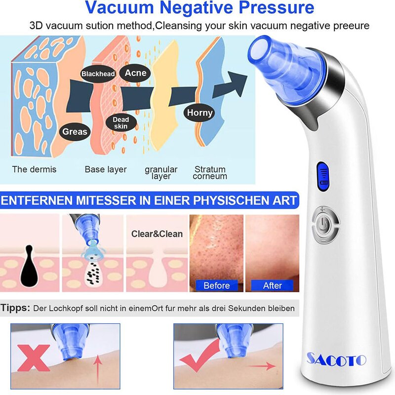Heated Vacuum Blackhead Remover - Electric Pimple Suction Extractor Kit