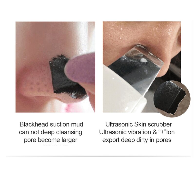 Electric Ultrasonic Spatula - US Home Use Face Nose Pore Deep Cleaner