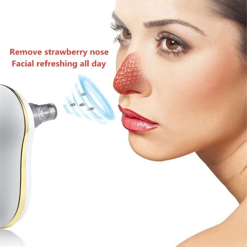 Blackhead Remover Vacuum - Strong Suction Facial Extractor Tool