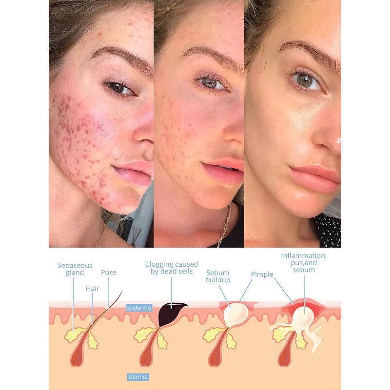 Facial Massager - Hot Selling Home Use Face Lifting Beauty Equipment