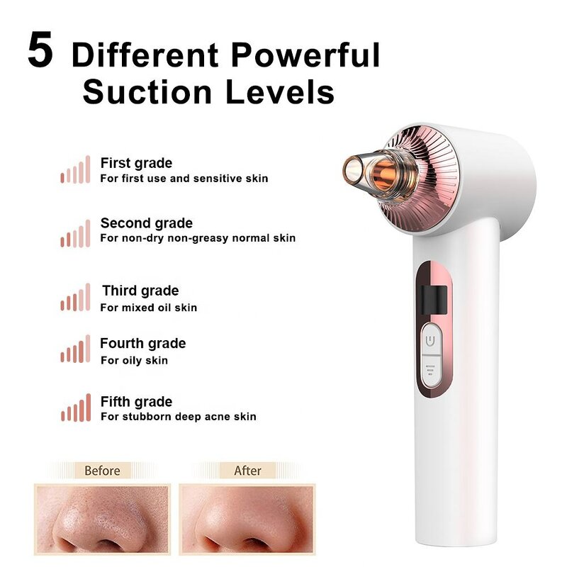 4 in 1 Pore Cleaner - Electric USB Pimples Removal Sucker Tool
