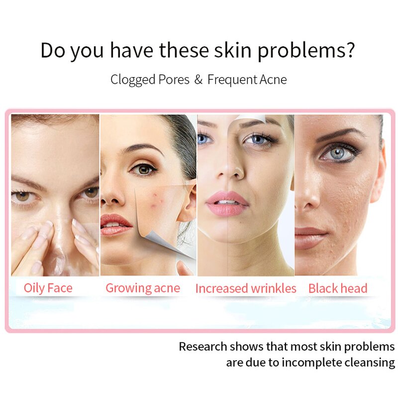 Portable Ultrasonic Skin Scrubber - High Frequency Blackhead Pore Cleaner