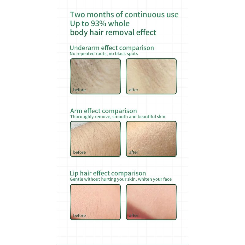 Rechargeable IPL Hair Remover - Painless Flash Laser Facial Body Tool