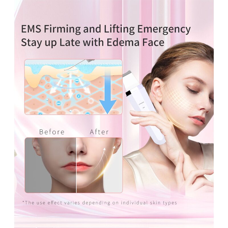 LED Light Face Massager - New Beauty Hand-Held Lifting Anti-Aging Tool