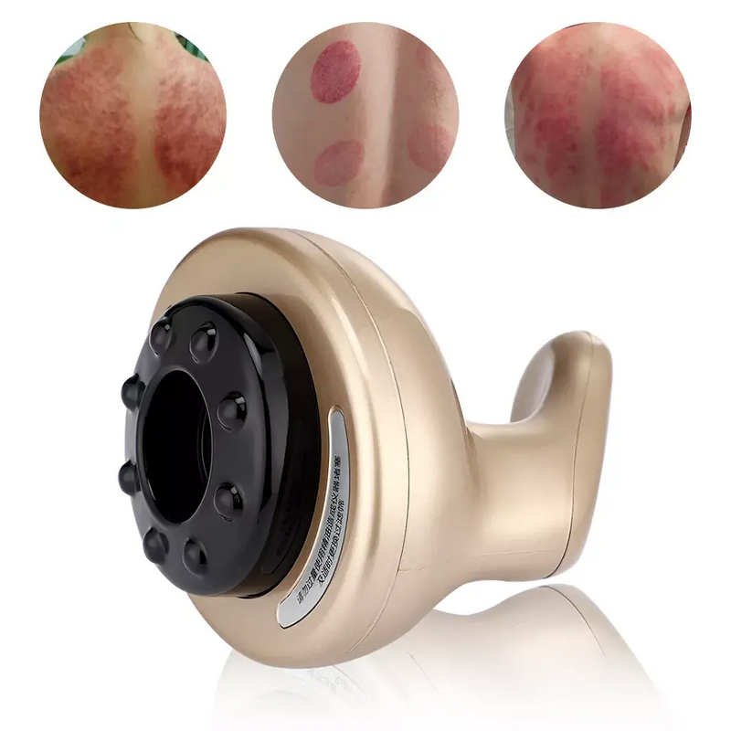 Cupping Therapy Device Manufacturer - Hot Selling 9-level Red Light Heating Intelligent Electric Vacuum